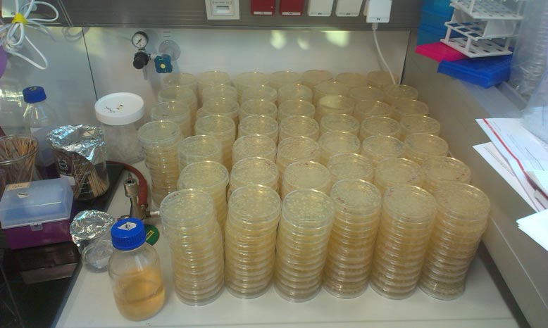 Photo of Escherichia coli colonies