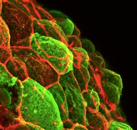 The image depicts a small region of the zebrafish Enveloping Layer (EVL), the early embryonic skin made of squamous epithelial cells. © Heisenberg Group