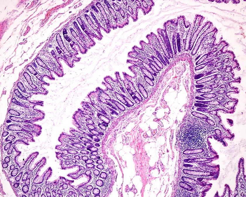 Curvature of cells in intestines. The curved tissue of the intestine walls maximizes the surface for the absorption of nutrients. © IST Austria
