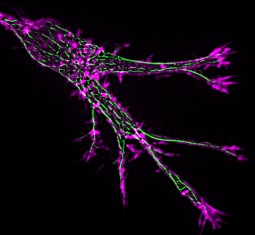 A cell with elements of its cytoskeleton visible. © Anna Akhmanova lab.