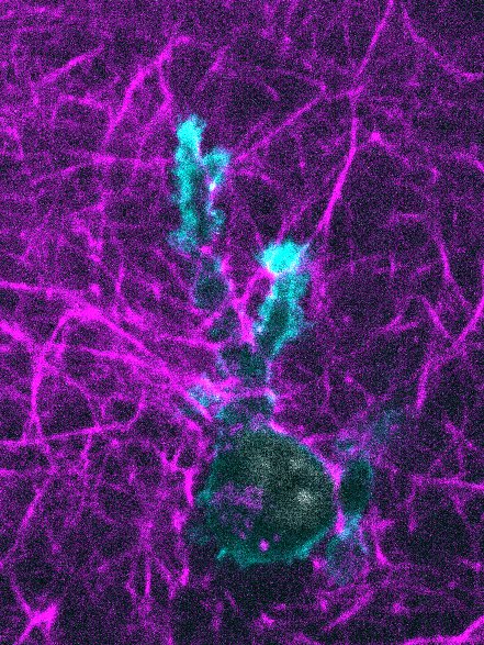 A dendritic cell crawls through a collagen gel.