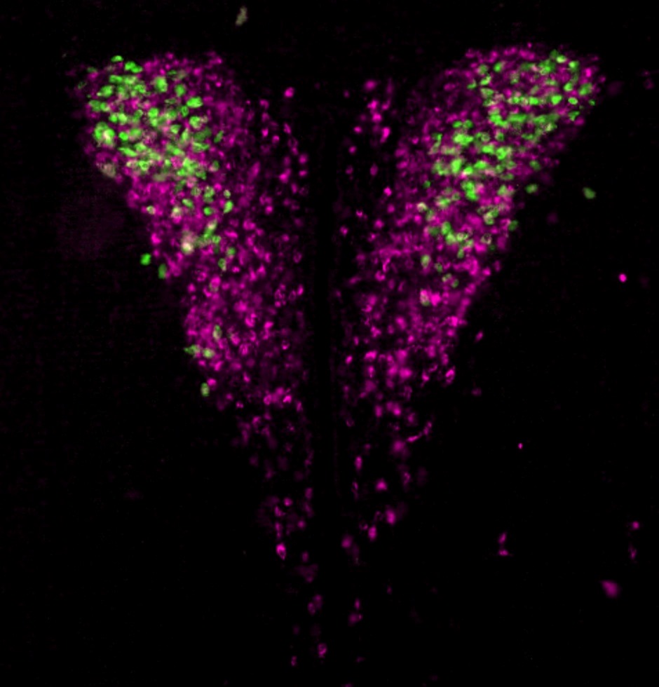 Hypothalamic neurons that control hormone secretion and those that specifically control the release of the stress hormone cortisol.