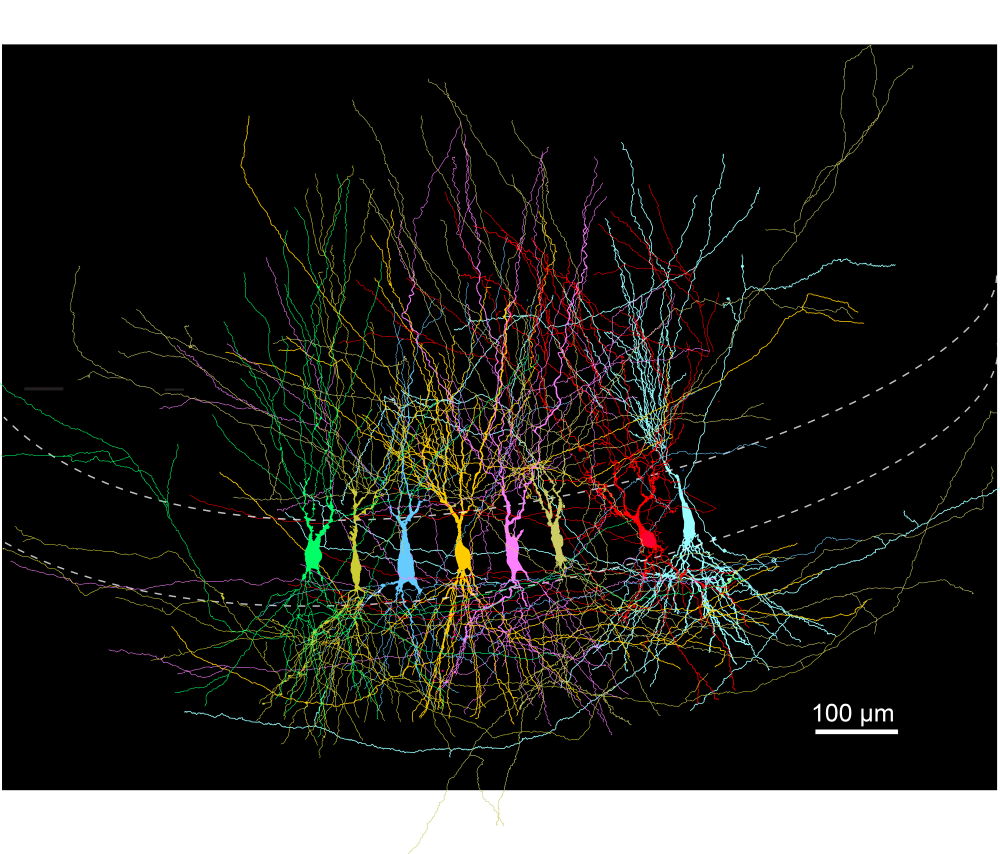 Collage of CA3 pyramidal neurons.