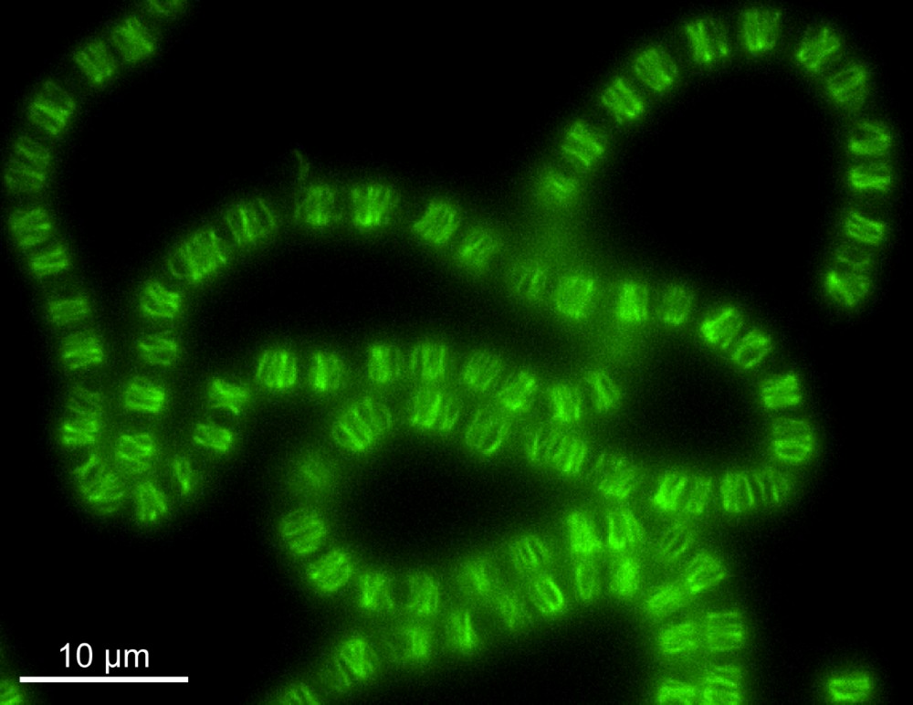 Fluorescently labelled CorM filaments inside Anabaena.