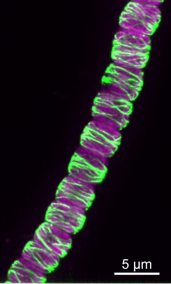 High-resolution image of CorM filaments in Anabaena.