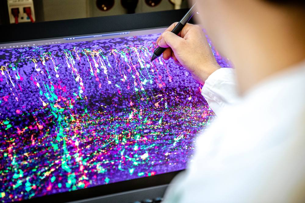 MADM technique. Using MADM (Mosaic Analysis with Double Markers), neurons can be tracked in vivo (in a living organism) in mice, and their lineage can be reconstructed.