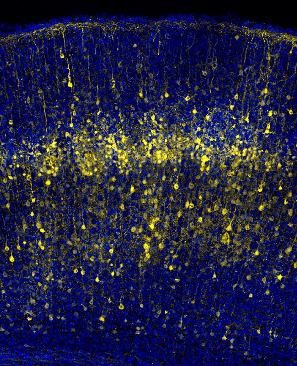Neurons in the developing mouse cerebral cortex labeled by in utero electroporation.